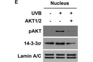 Western Blotting (WB) image for anti-Stratifin (SFN) antibody (ABIN2854867)