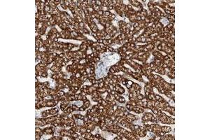 Immunohistochemical staining of human liver with TAS2R60 polyclonal antibody  shows cytoplasmic positivity in hepatocytes at 1:50-1:200 dilution. (TAS2R60 抗体)
