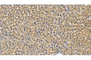 Detection of RIPK1 in Rat Liver Tissue using Polyclonal Antibody to Receptor Interacting Serine Threonine Kinase 1 (RIPK1)