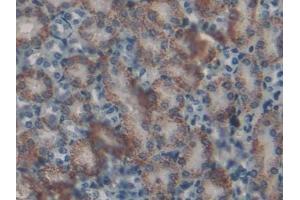 Detection of CAT in Mouse Kidney Tissue using Polyclonal Antibody to Catalase (CAT) (Catalase 抗体  (AA 32-157))