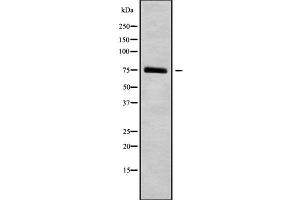 Western blot analysis of HGFAC using NIH-3T3 whole cell lysates (HGFA 抗体  (C-Term))