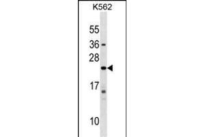 IFNA10 Antibody (C-term) (ABIN1536759 and ABIN2849164) western blot analysis in K562 cell line lysates (35 μg/lane). (IFNA10 抗体  (C-Term))