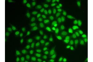 Immunofluorescence analysis of U2OS cells using UBE2V1 antibody. (UBE2V1 抗体  (AA 1-147))