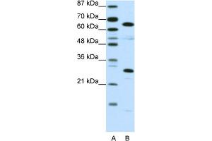 WB Suggested Anti-HMGB4 Antibody Titration:  0. (HMGB4 抗体  (C-Term))