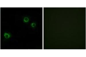 Immunofluorescence analysis of HuvEc cells, using CLDN6 Antibody. (Claudin 6 抗体  (AA 81-130))