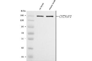 Western blot analysis of Caspr2/CNTNAP2 using anti-Caspr2/CNTNAP2 antibody (ABIN7601487).