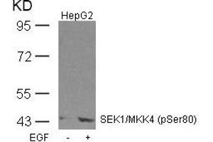Western blot analysis of extracts from HepG2 cells untreated or treated with EGF using SEK1/MKK4(Phospho-Ser80) Antibody. (MAP2K4 抗体  (pSer80))