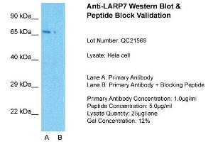 Host: Rabbit  Target Name: LARP7  Sample Tissue: Hela Whole cell  Lane A:  Primary Antibody Lane B:  Primary Antibody + Blocking Peptide Primary Antibody Concentration: 1 µg/mL Peptide Concentration: 5 µg/mL Lysate Quantity: 41 µg/laneGel Concentration:.