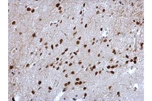 Immunohistochemistry (IHC) image for anti-Cyclin T2 (CCNT2) (C-Term) antibody (ABIN2856837)