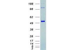 Western Blotting (WB) image for Cyclin-Dependent Kinase 8 (CDK8) protein (Myc-DYKDDDDK Tag) (ABIN2713871)