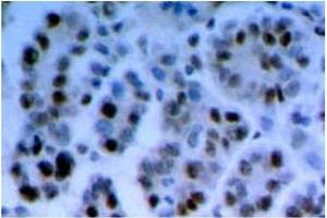 Immunohistochemistry (IHC) image for anti-RAD17 (RAD17) antibody (ABIN492574) (RAD17 抗体)