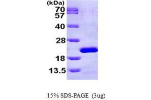 SDS-PAGE (SDS) image for Eukaryotic Translation Initiation Factor 1A, X-Linked (EIF1AX) (AA 1-144) protein (His tag) (ABIN667210) (EIF1AX Protein (AA 1-144) (His tag))