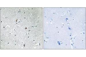 Immunohistochemistry analysis of paraffin-embedded human brain, using mTOR (Phospho-Ser2448) Antibody. (MTOR 抗体  (pSer2448))