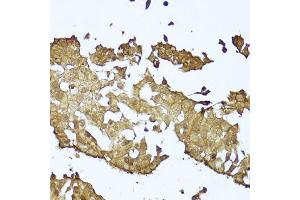 Immunohistochemistry (Paraffin-embedded Sections) (IHC (p)) image for anti-Catenin (Cadherin-Associated Protein), beta 1, 88kDa (CTNNB1) (AA 1-100) antibody (ABIN6139205)