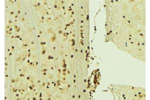 ABIN6276474 at 1/100 staining Mouse brain tissue by IHC-P. (MCM3 抗体  (N-Term))
