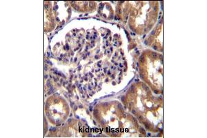 TLL2 Antibody (N-term) (ABIN392519 and ABIN2842079) immunohistochemistry analysis in formalin fixed and paraffin embedded human kidney tissue followed by peroxidase conjugation of the secondary antibody and DAB staining. (Tolloid-Like 2 抗体  (N-Term))