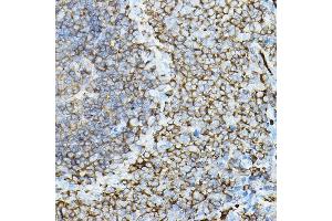 Immunohistochemistry of paraffin-embedded rat spleen using PRKCB Rabbit pAb (ABIN6128462, ABIN6146199, ABIN6146201 and ABIN6217699) at dilution of 1:50 (40x lens). (PKC beta 抗体  (AA 1-270))
