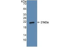 Detection of Recombinant PRDM1, Human using Polyclonal Antibody to PR Domain Containing Protein 1 (PRDM1) (PRDM1 抗体  (AA 29-149))