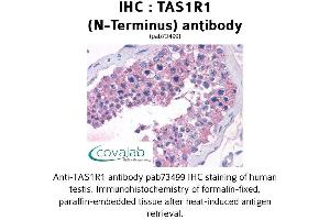 Image no. 1 for anti-Taste Receptor, Type 1, Member 1 (TAS1R1) (Extracellular Domain), (N-Term) antibody (ABIN1739915) (TAS1R1 抗体  (Extracellular Domain, N-Term))