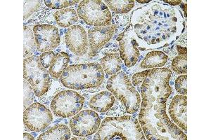 Immunohistochemistry of paraffin-embedded Rat kidney using CDH16 Polyclonal Antibody at dilution of 1:100 (40x lens).