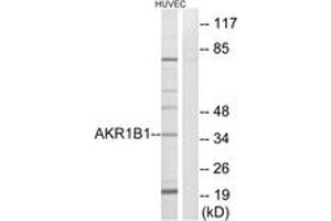 Western blot analysis of extracts from HuvEc cells, using AKR1B1 Antibody. (AKR1B1 抗体  (AA 241-290))