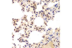 Immunohistochemistry of paraffin-embedded mouse lung using CSNK2 antibody (ABIN6127663, ABIN6139128, ABIN6139129 and ABIN6217497) at dilution of 1:100 (40x lens). (CSNK2A2 抗体  (AA 1-350))