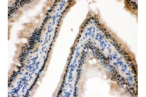 Anti- HINT1 Picoband antibody, IHC(P) IHC(P): Mouse Intestine Tissue (HINT1 抗体  (Middle Region))