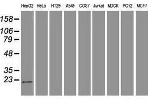 Western blot analysis of extracts (35 µg) from 9 different cell lines by using anti-AK1 monoclonal antibody. (Adenylate Kinase 1 抗体)