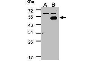 WB Image Western Blot analysis of NR2F1 expression in transfected 293T cell line by NR2F1 polyclonal antibody. (NR2F1 抗体  (N-Term))