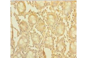 Immunohistochemistry of paraffin-embedded human colon tissue using ABIN7148176 at dilution of 1:100 (CCDC94 抗体  (AA 1-279))