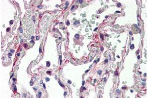 Human Lung (formalin-fixed, paraffin-embedded) stained with IL27 antibody ABIN337287 at 5 ug/ml followed by biotinylated goat anti-rabbit IgG secondary antibody ABIN481713, alkaline phosphatase-streptavidin and chromogen. (IL-27 抗体  (N-Term))