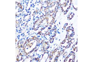 Immunohistochemistry (IHC) image for anti-Serine/threonine-Protein Kinase MST4 (MST4) (AA 297-416) antibody (ABIN7270231)