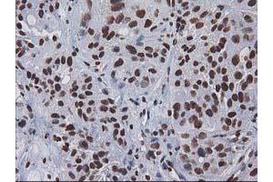 Image no. 9 for anti-CTD (Carboxy-terminal Domain, RNA Polymerase II, Polypeptide A) Small Phosphatase 1 (CTDSP1) antibody (ABIN1497679) (CTDSP1 抗体)