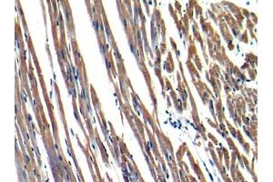 DAB staining on IHC-P; Samples: Rat Heart Tissue (MYH6 抗体  (AA 1747-1938))