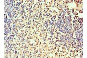 Immunohistochemistry of paraffin-embedded human spleen tissue using ABIN7146696 at dilution of 1:100 (CA1 抗体  (AA 1-261))