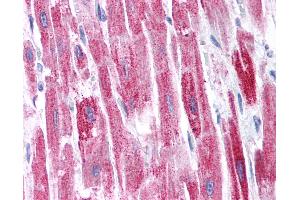 Anti-KCTD13 antibody IHC of human heart. (KCTD13 抗体  (AA 26-75))