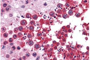 Human Testis: Formalin-Fixed, Paraffin-Embedded (FFPE) (RUVBL2 抗体  (AA 304-458))