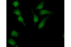Detection of SULF2 in Human HepG2 Cells using Polyclonal Antibody to Sulfatase 2 (SULF2) (SULF2 抗体  (AA 337-649))