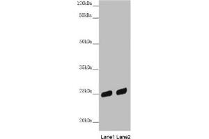 Western blot All lanes: PSPH antibody at 3. (PSPH 抗体  (AA 1-225))