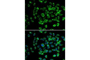 Immunofluorescence analysis of U2OS cells using PSMD13 antibody. (PSMD13 抗体)