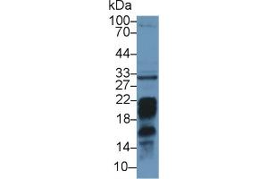 Detection of PDL2 in Mouse Liver lysate using Polyclonal Antibody to Programmed Cell Death Protein 1 Ligand 2 (PDL2) (PDCD1LG2 抗体  (AA 36-219))