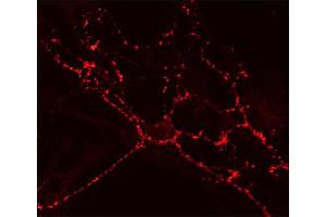 Indirect immunostaining of cultured hippocampus neurons (dilution 1 : 200). (SV2A 抗体  (AA 2-17))