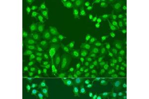 Immunofluorescence analysis of U2OS cells using CTCF Polyclonal Antibody at dilution of 1:100. (CTCF 抗体)