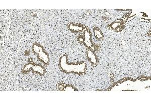 IHC analysis of ERK5/MAPK7 using anti-ERK5/MAPK7 antibody (ABIN7600701). (MAPK7 抗体  (AA 22-816))