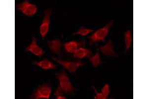 ABIN6266829 staining HepG2 by IF/ICC. (Cyclin-Dependent Kinase 15 (ALS2CR7) (Internal Region) 抗体)