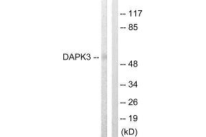 Western Blotting (WB) image for anti-Death-Associated Protein Kinase 3 (DAPK3) (Thr265) antibody (ABIN1848018) (DAPK3 抗体  (Thr265))