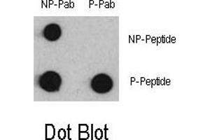 Image no. 1 for anti-Myocyte Enhancer Factor 2C (MEF2C) (pSer387) antibody (ABIN358336) (MEF2C 抗体  (pSer387))