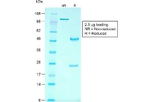 SDS-PAGE Analysis Purified Glypican-3 Mouse Recombinant Monoclonal Ab (rGPC3/863). (Recombinant Glypican 3 抗体)
