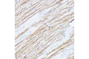 Immunohistochemistry of paraffin-embedded mouse heart using MGLL Rabbit pAb (ABIN6128306, ABIN6143823, ABIN6143824 and ABIN6222352) at dilution of 1:50 (40x lens). (MGLL 抗体  (AA 1-303))