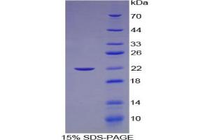 SDS-PAGE analysis of Human Laminin gamma 2 Protein. (LAMC2 蛋白)